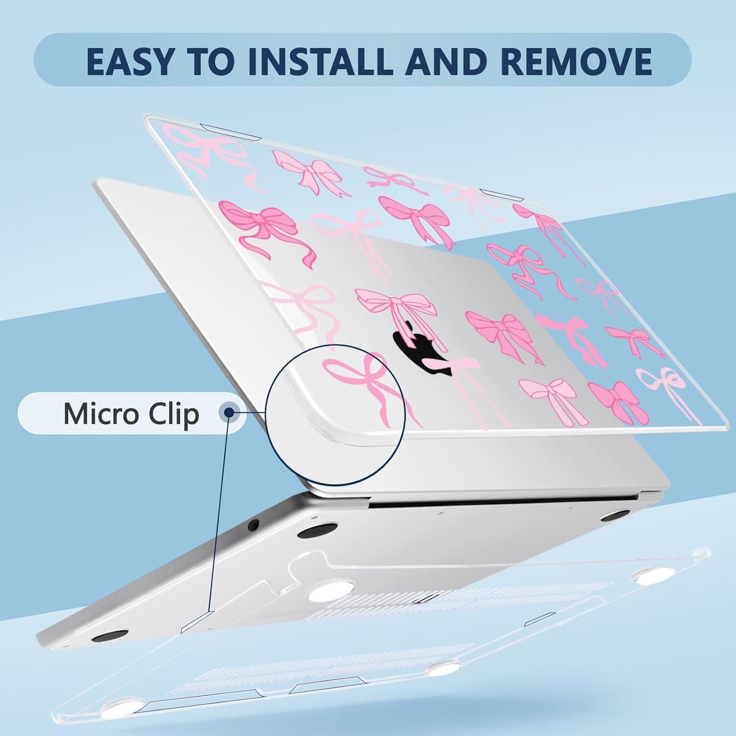 Compatible with MacBook Air 13.6 inch Case, M4 A3240/M3 A3113/M2 A2681 (Released 2025 to 2022), Hard Shell, Keyboard Cover, Screen Protector, Webcam Cover & Type-C Adapter, Pink Bows